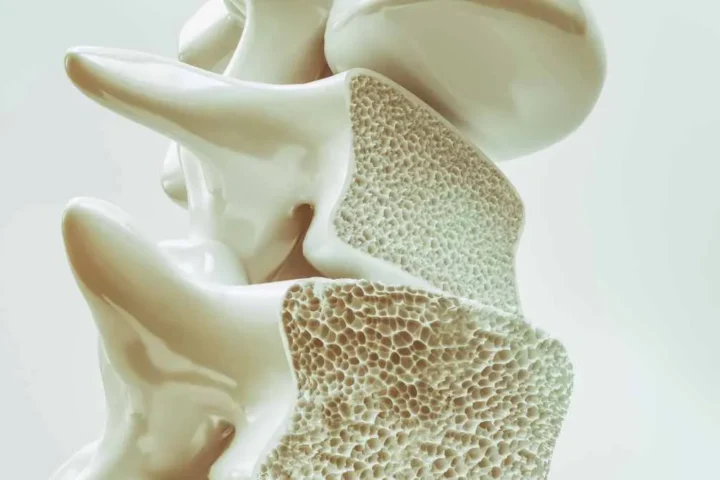 Osteoporosi: sintomi e prevenzione - Poliambulatorio specialistico vicino Ferrara a Vigarano mainarda